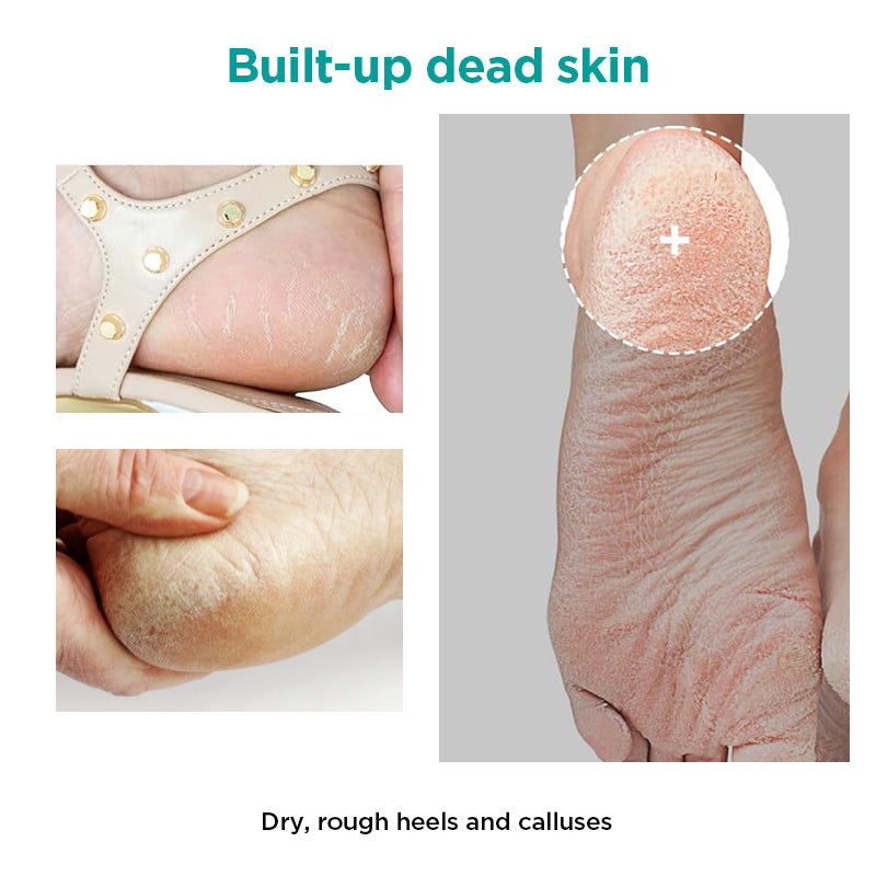 Ariul Smooth & Pure Foot Peeling Mask Soothing (Aloe) 34g