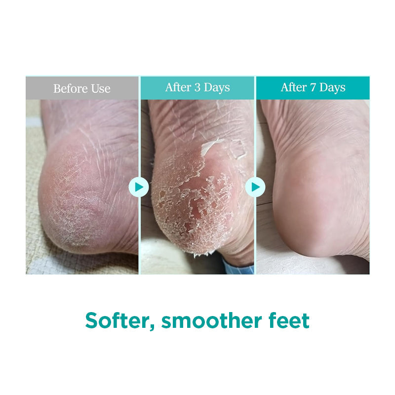 Ariul Smooth & Pure Foot Peeling Mask Calming (Tea Tree) 34g