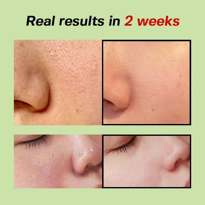 Sungboon Editor Green Tomato Pore Lifting Ampoule+ (75ml)