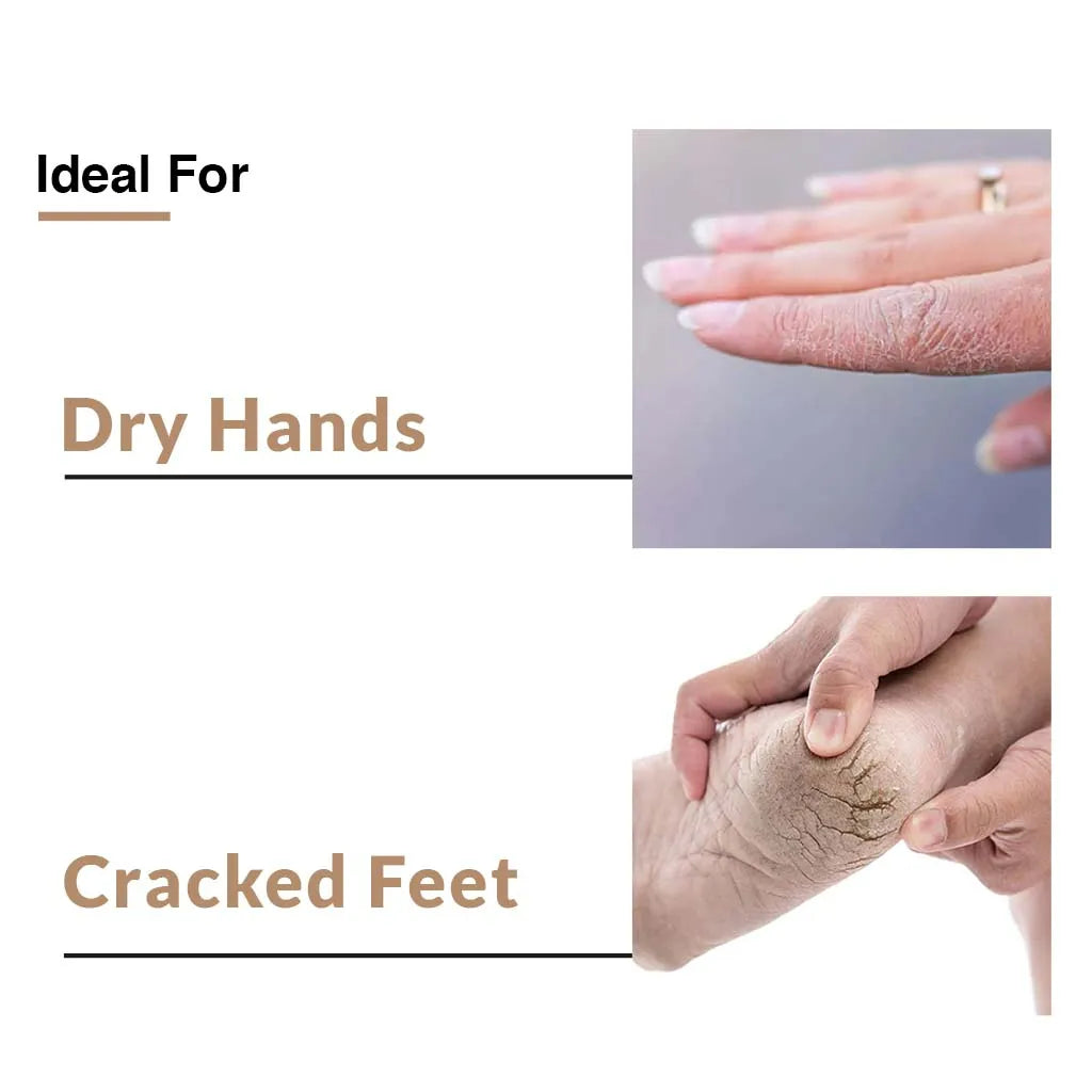 Fixderma Hand and Foot Cream Combo