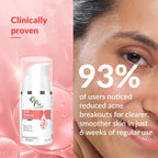 Fixderma Acne Defence Face Serum 10g