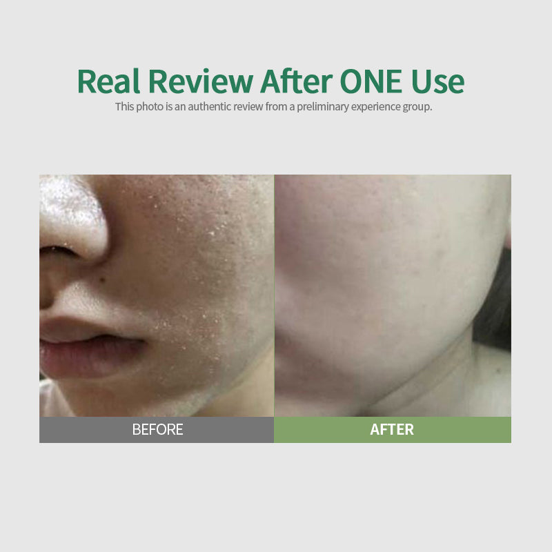 Sungboon Editor Green Tomato Deep Pore Clean Enzyme Powder Wash -   (1.5g/10ea)