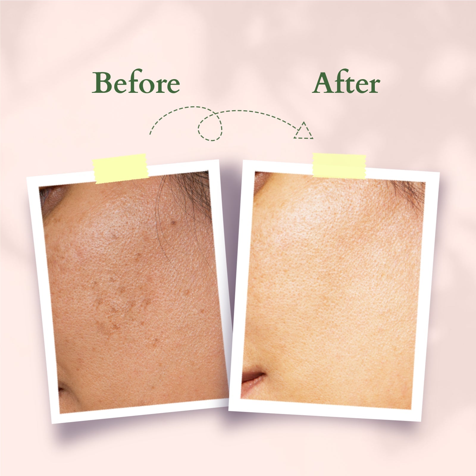 Lotus Precious Brightening Facial Oil