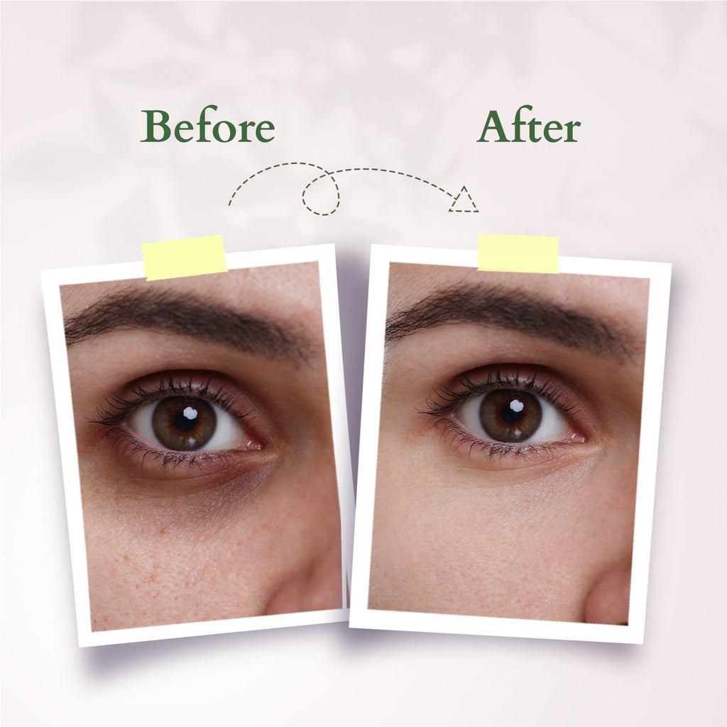 Lotus Precious Brightening Under Eye Cream