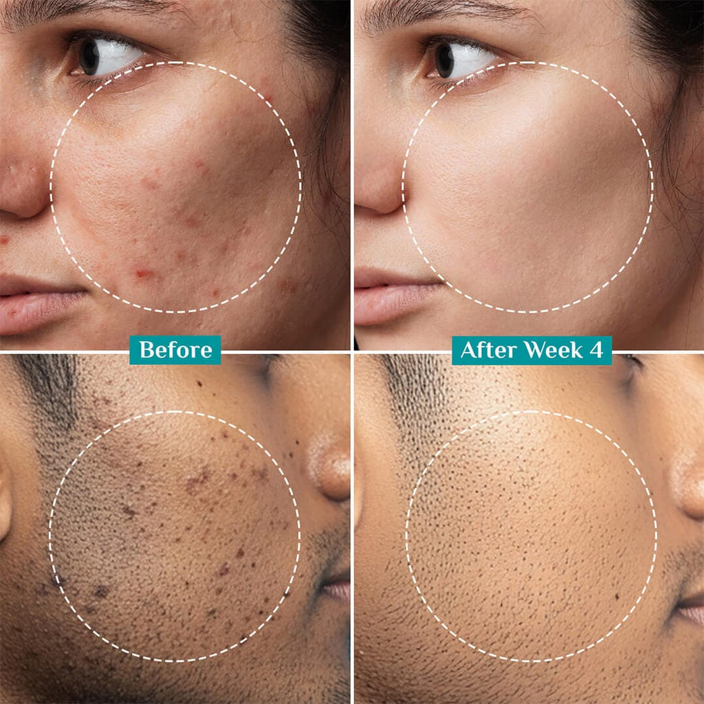 Pilgrim 2% Alpha Arbutin Brightening Serum