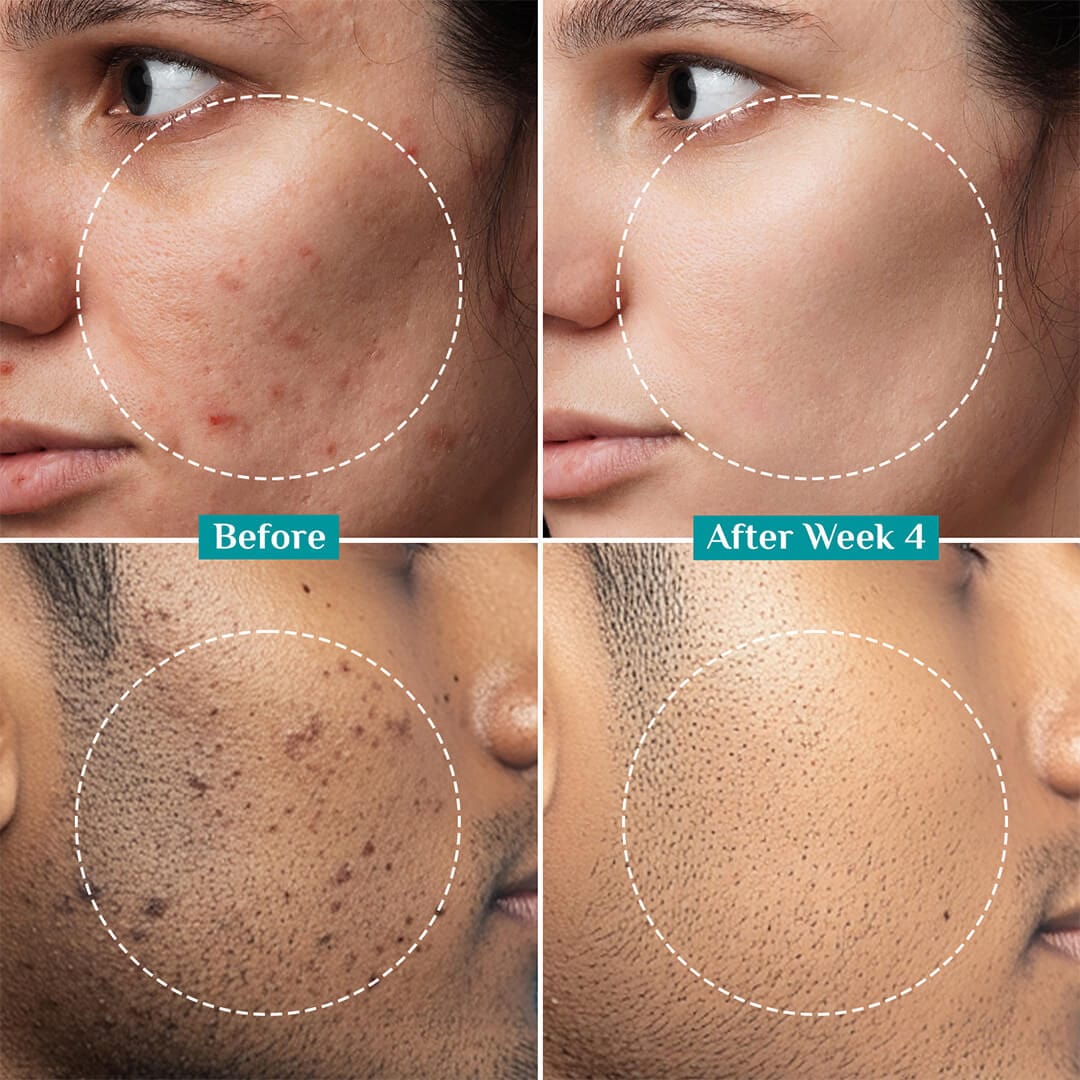 Pilgrim 2% Alpha Arbutin Brightening Serum