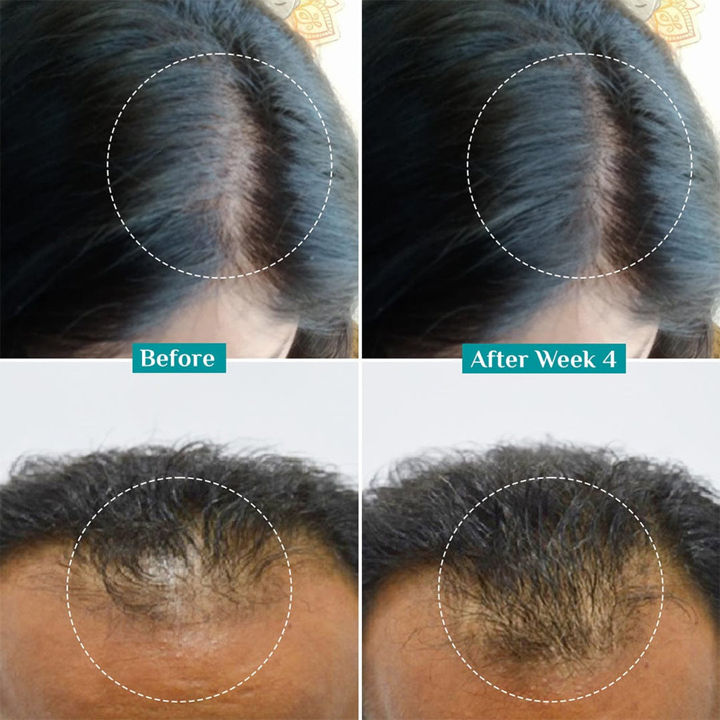 Pilgrim 3% Redensyl & 4% Anagain Advanced Hair Growth Serum 100 ml