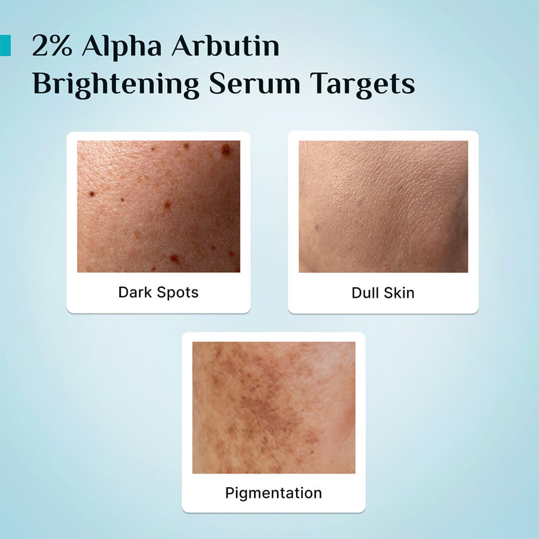 Pilgrim 2% Alpha Arbutin Brightening Serum