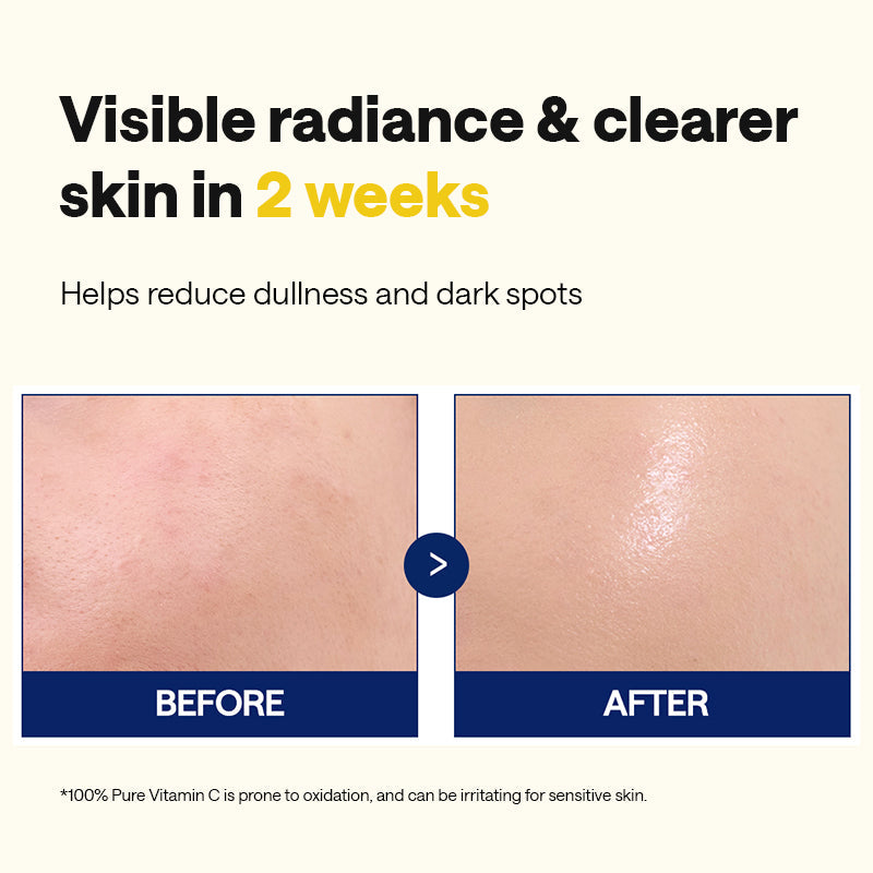 MEDIHEAL Vitamin C Brightening Serum - 40ml