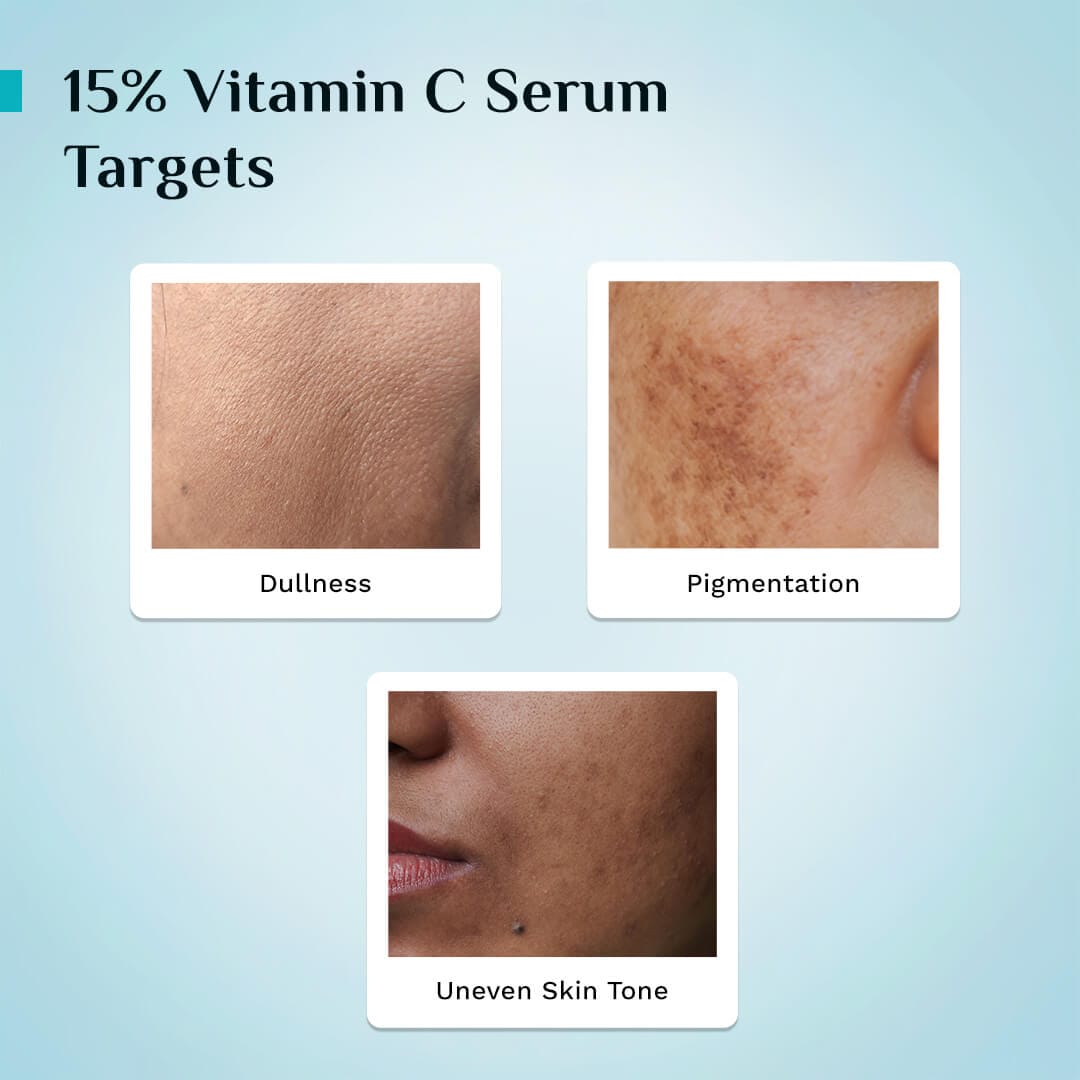 Pilgrim 15% Vitamin C Face Serum For Advanced Brightness (20 ml)