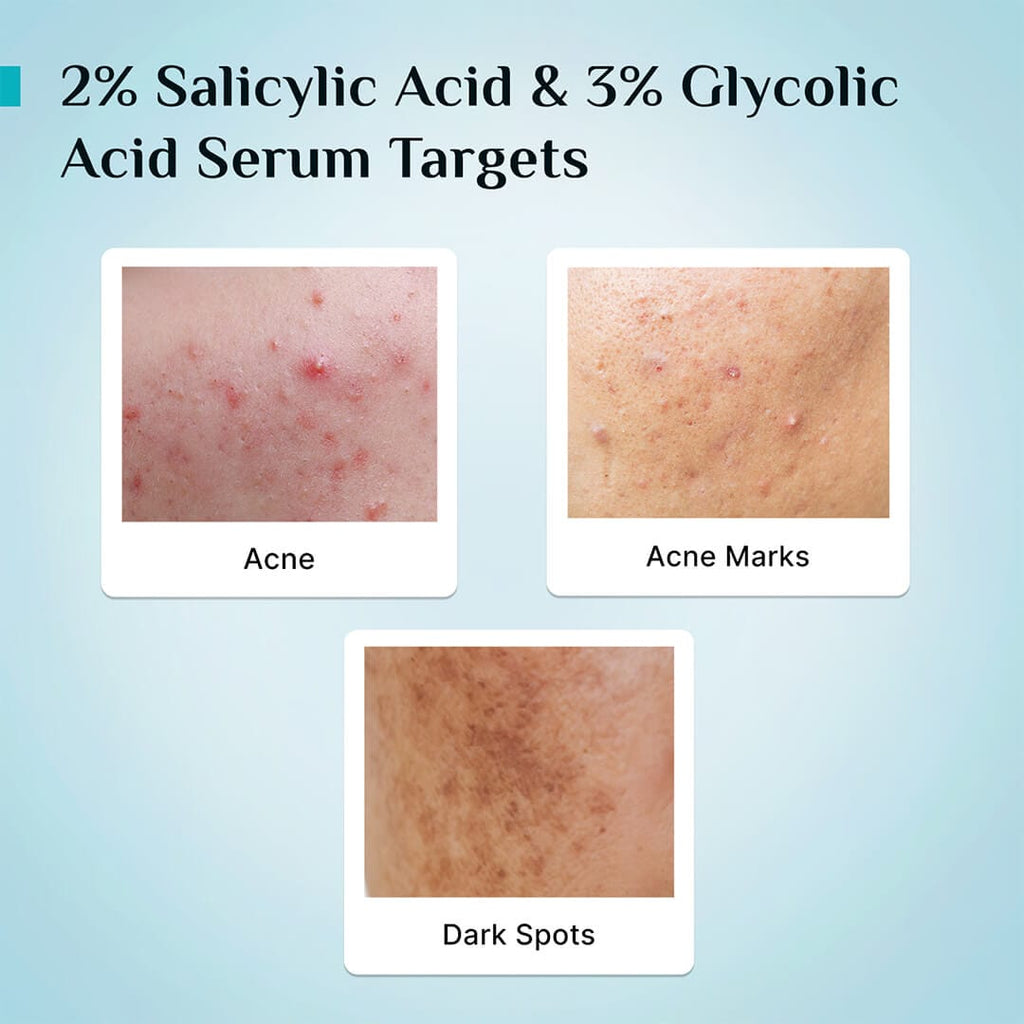 Pilgrim 2% Salicylic Acid Anti-Acne Face Serum