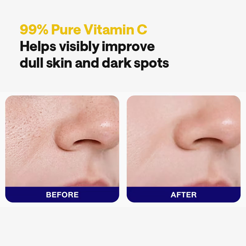 MEDIHEAL Vitamin C Essential Mask Clear Toning - 24ml