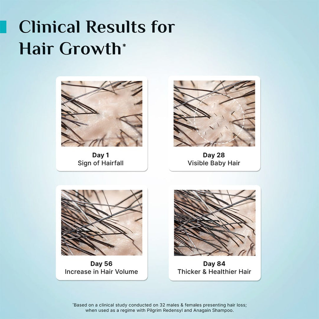 Pilgrim 3% Redensyl & 4% Anagain Advanced Hair Growth Serum 100 ml