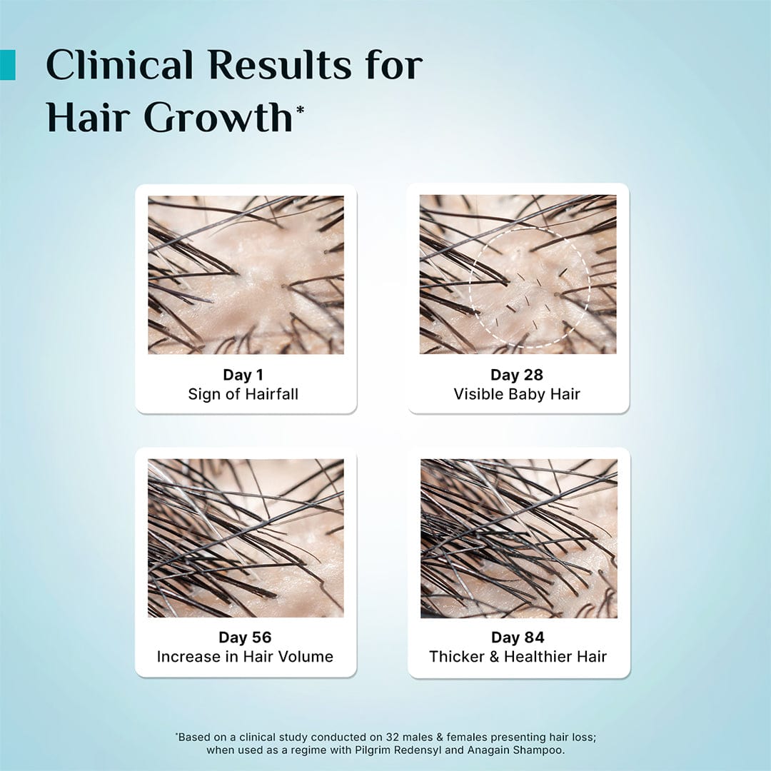 Pilgrim 3% Redensyl & 4% Anagain Advanced Hair Growth Serum 100 ml