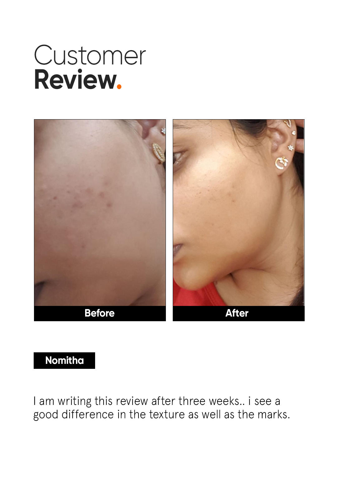 Minimalist AHA PHA BHA 32% Face Peel