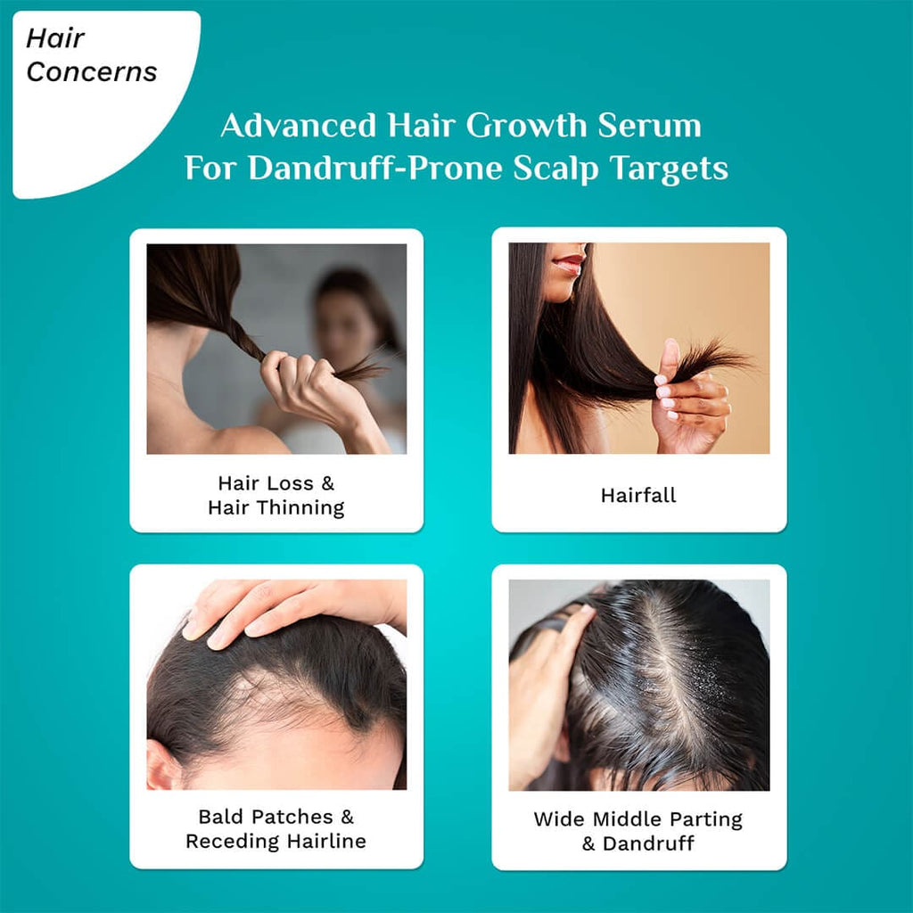 Pilgrim 3% Redensyl & 4% Anagain Advanced Hair Growth Serum For Dandruff-Prone Scalp - 30 ml