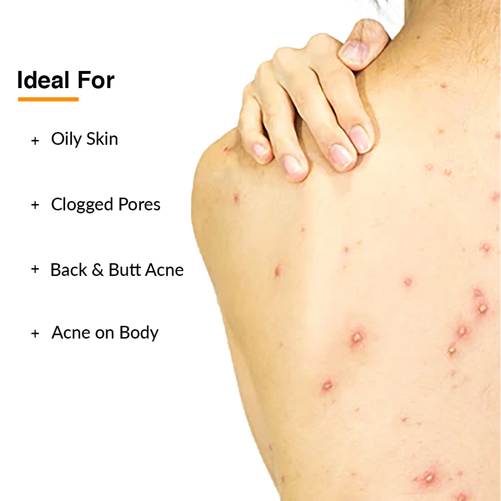 Fixderma Salyzap Acne Body Wash 15ml