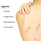 Fixderma Salyzap Acne Body Wash 15ml