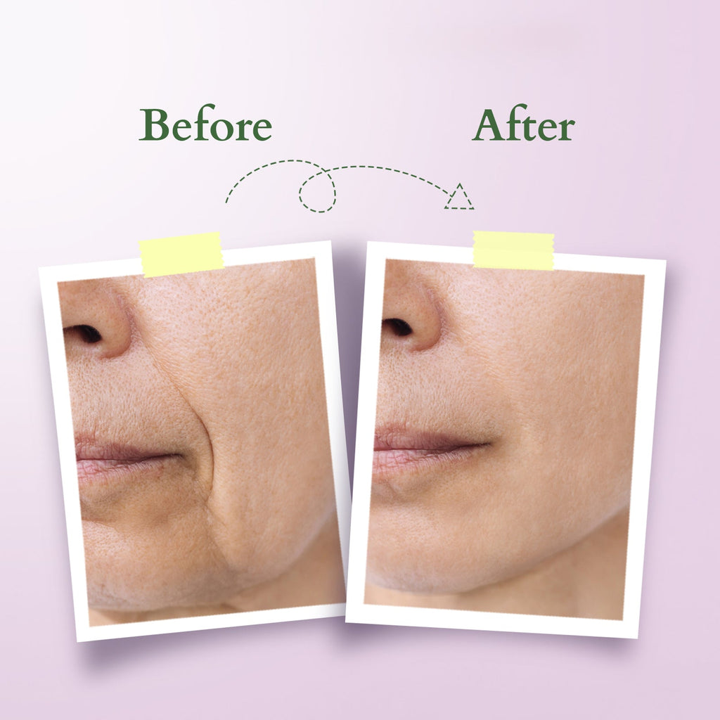 Lotus Bakuchiol Plant Retinol Miracle Face Oil