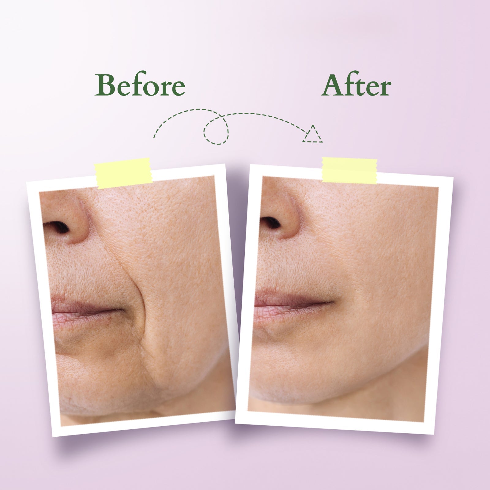 Lotus Bakuchiol Plant Retinol Miracle Face Oil