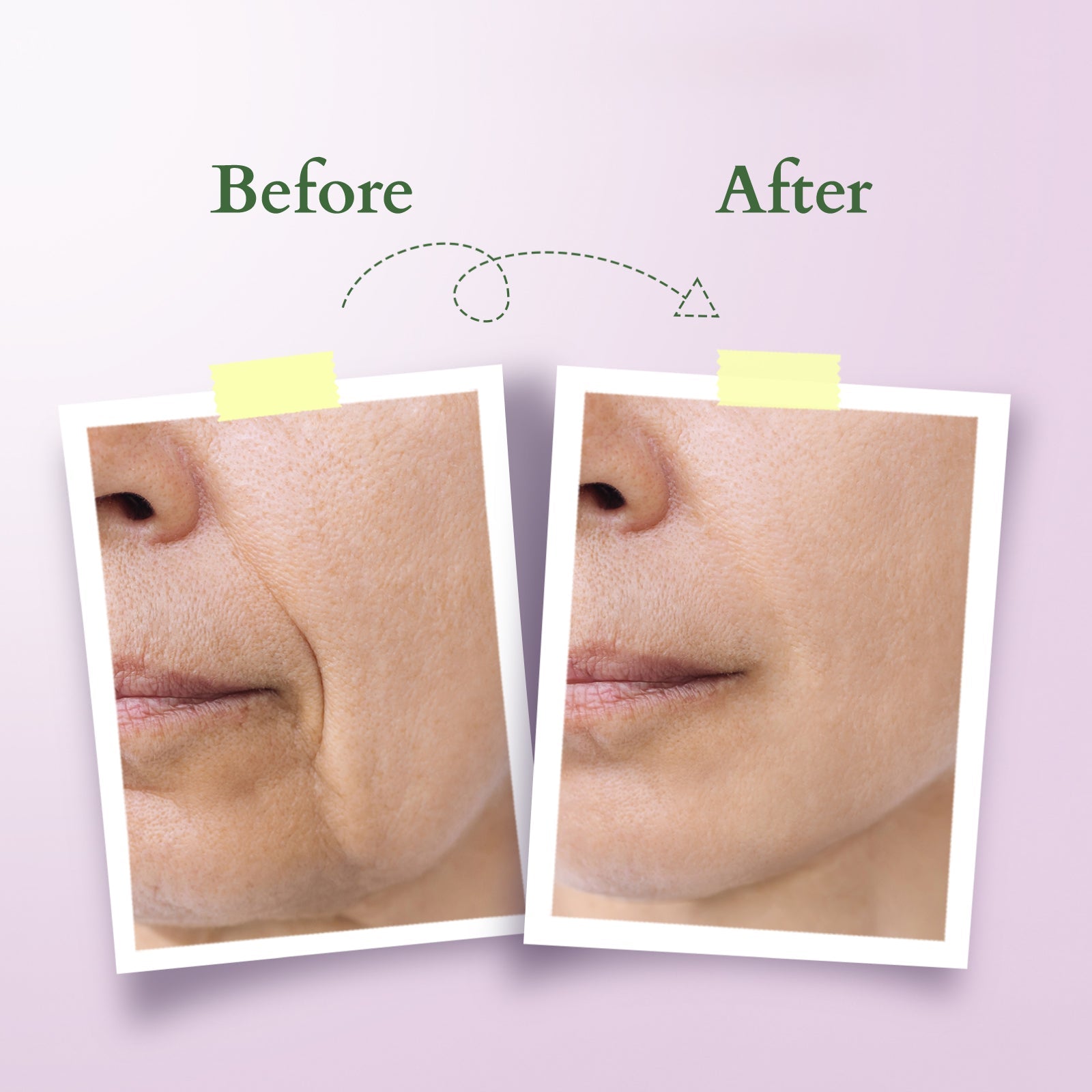 Lotus Bakuchiol Plant Retinol Super Serum