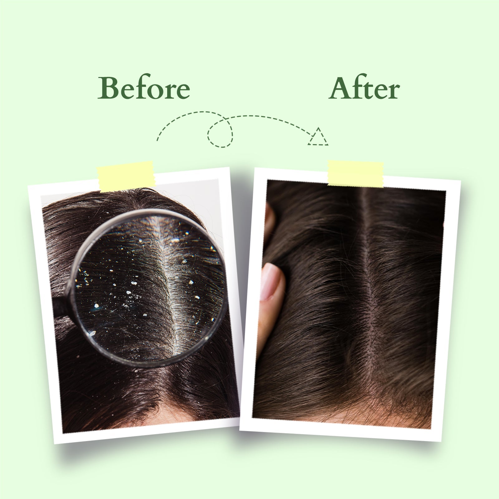 Lotus Organics+ Chemical-Free Anti-Dandruff Shampoo