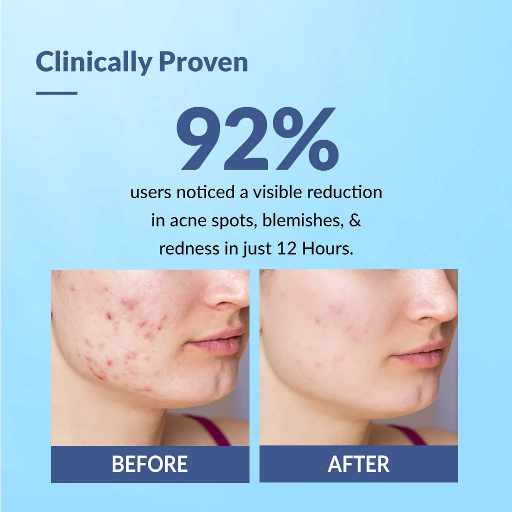 Fixderma Fixderma Salyzap Acne Spot Corrector Gel