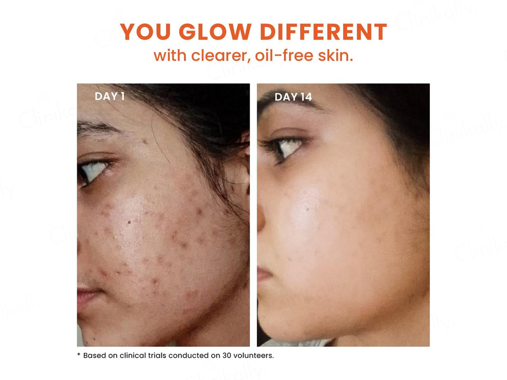 Foxtale 12% Niacinamide + Azelaic Acid Clarifying Serum
