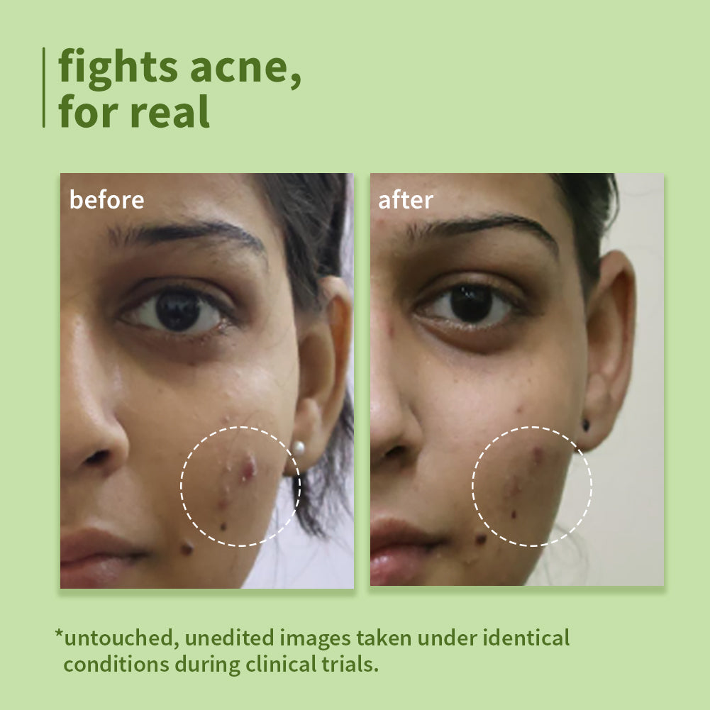 Plum Green Tea Pore Cleansing Face Wash for Acne