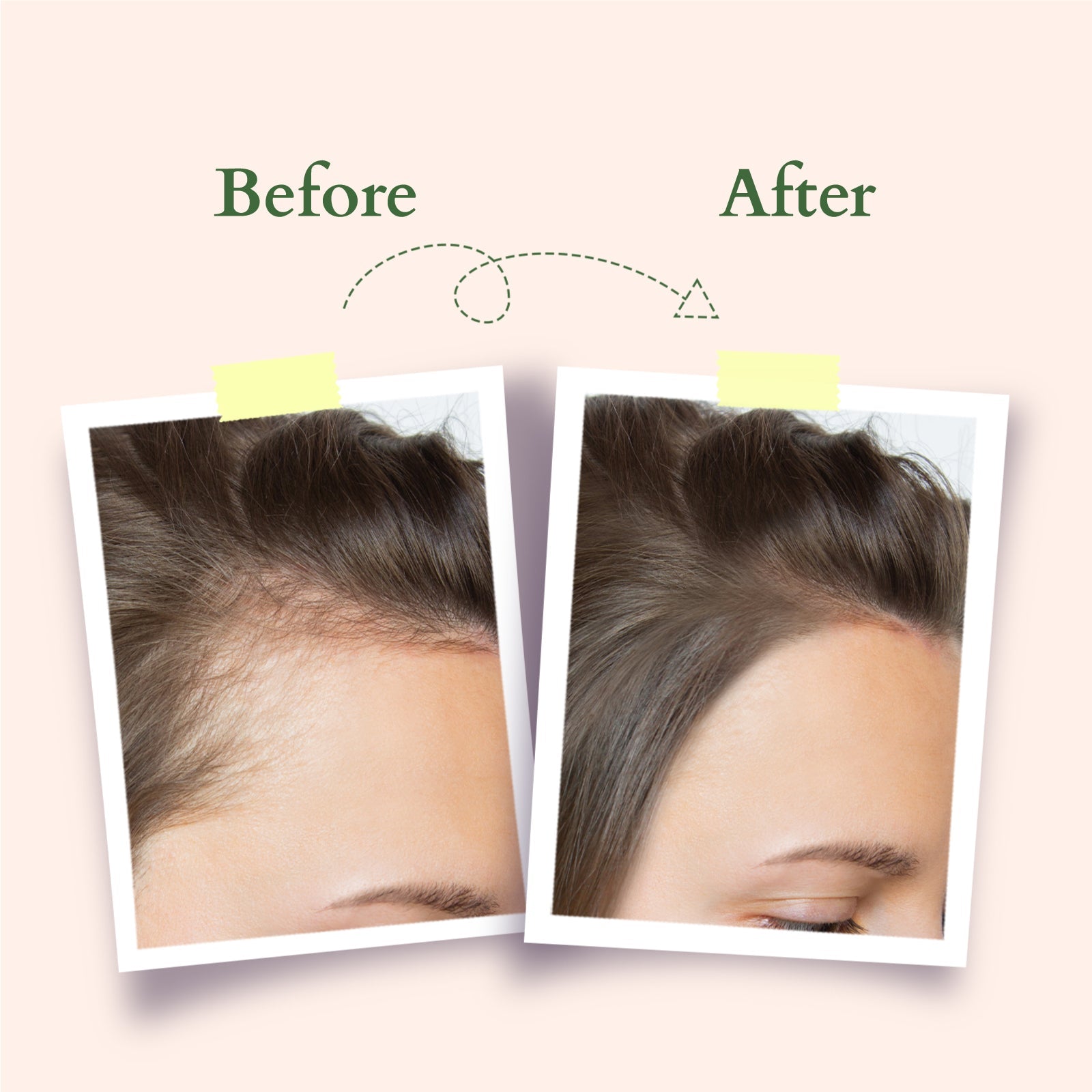 Lotus Organics+ Hair Fall Control Multi Herbs Oil