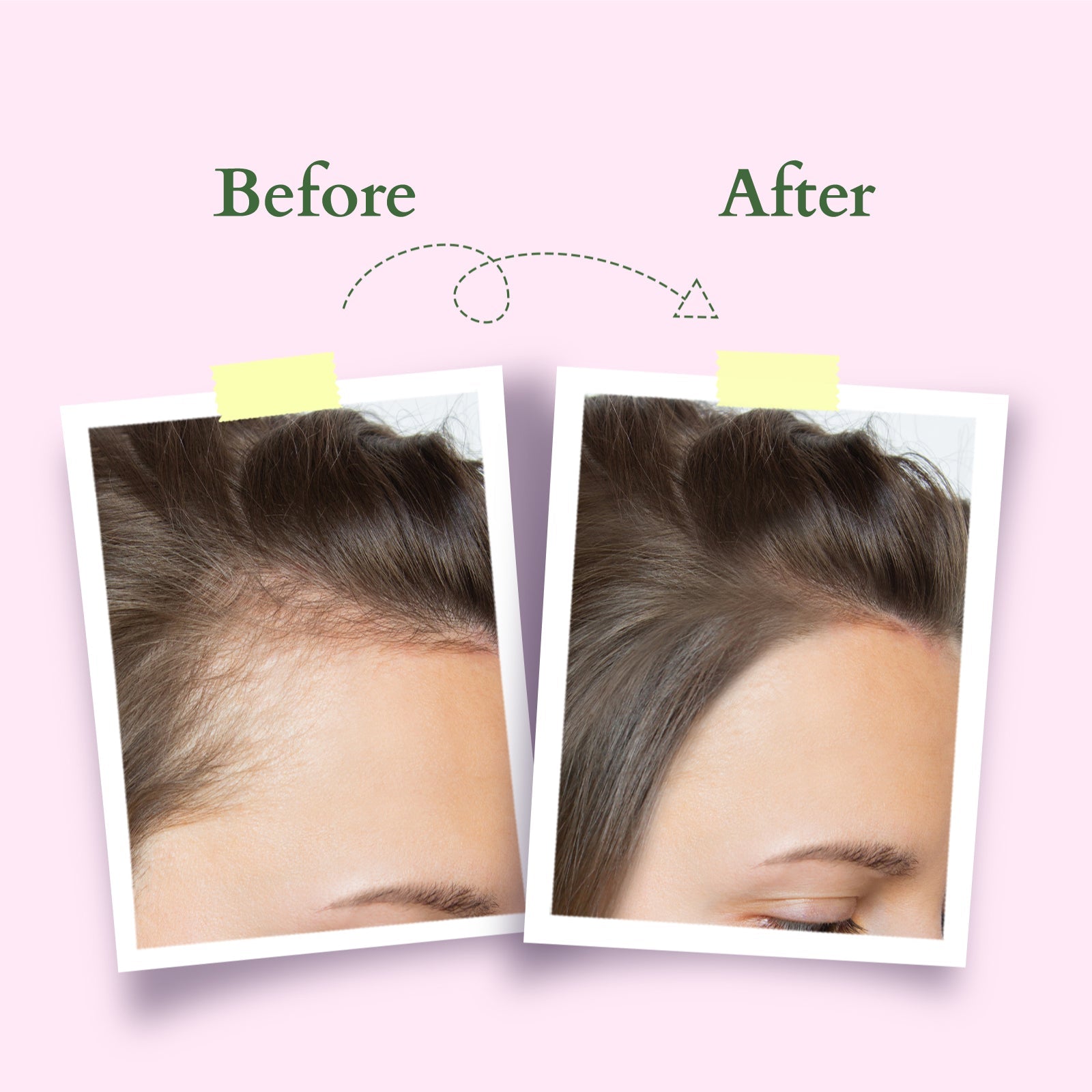 Lotus Organics+ Hair Growth Active-Concentrate Serum