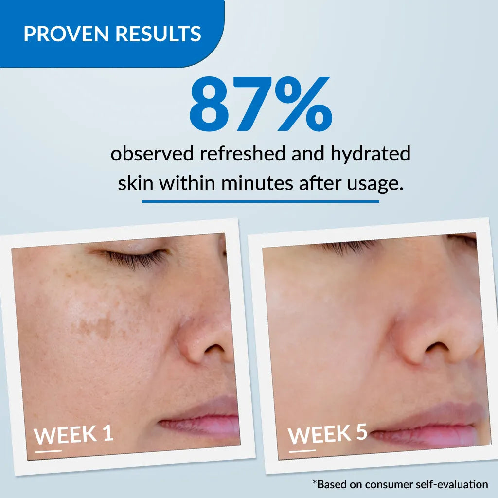 Fixderma Peelonate Brightening Kit