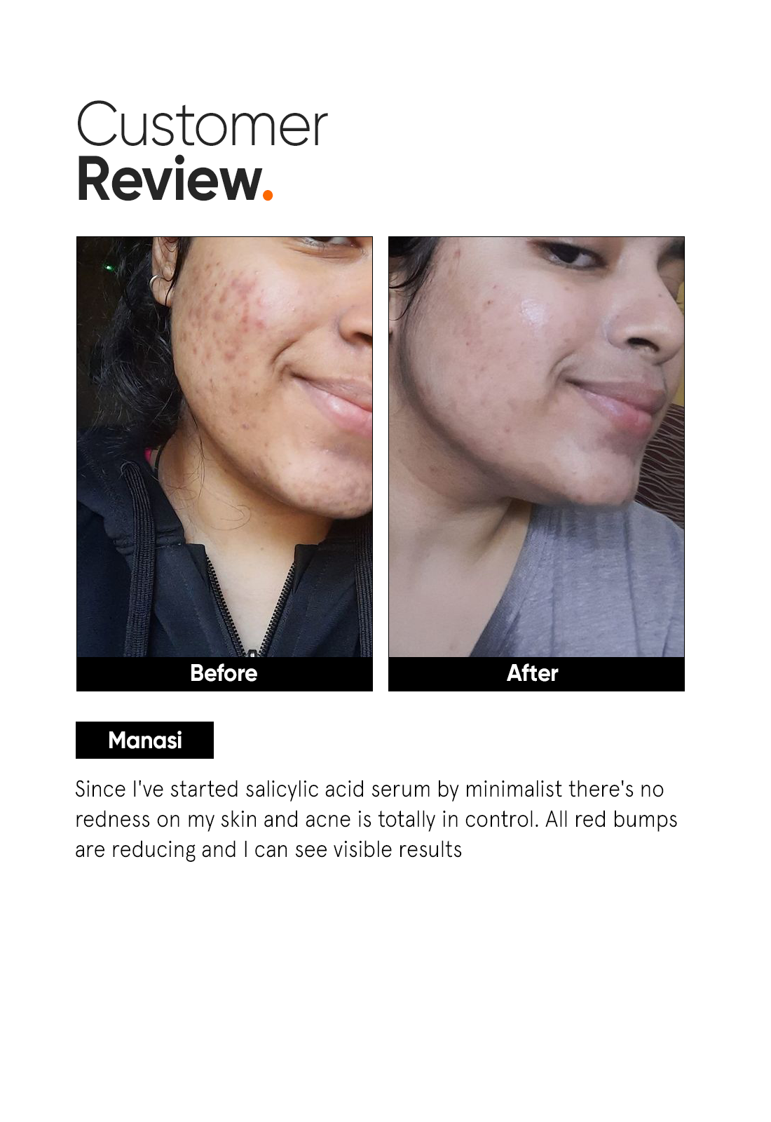 Minimalist Salicylic Acid 2% Face Serum