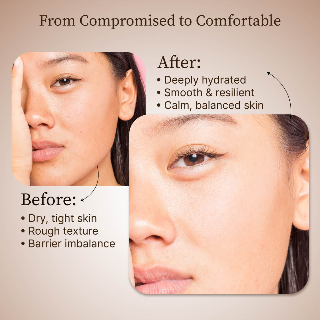 Dr.Reju-All Advanced LC-Ceramide Barrier Cream - 50ml