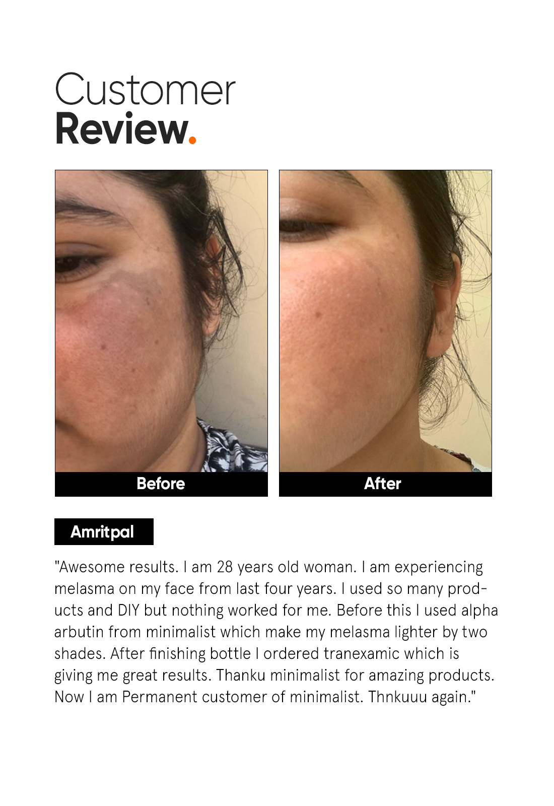 Minimalist Tranexamic 3% Face Serum