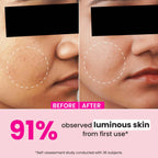 Dot & Key Watermelon 10% Glycolic Serum for Face Glowing,20 ml