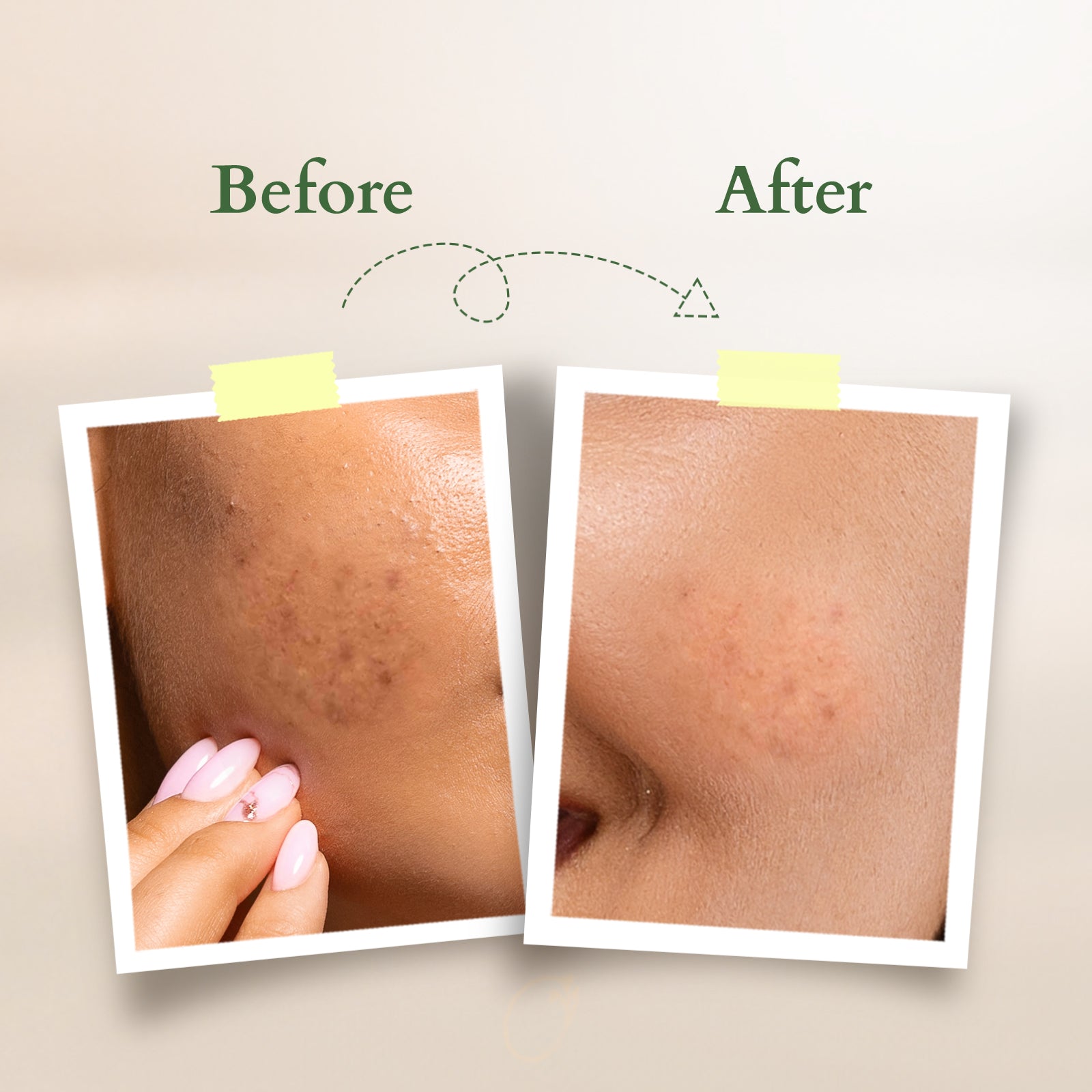 Lotus Organics+ Vitamin-C Glow Face Oil