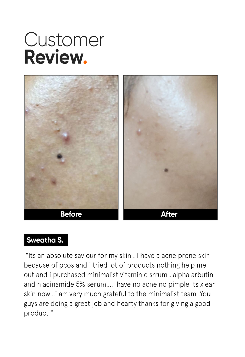Minimalist Vitamin C 10% Face Serum