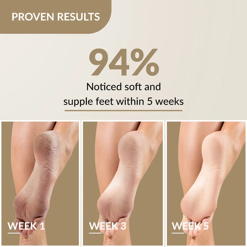 Fixderma Foobetik Foot Scrub Spray and  Foot Cream