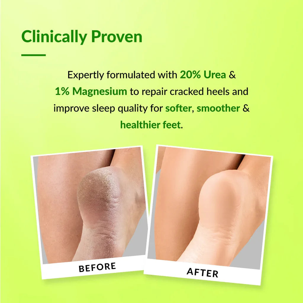 Fixderma Foobetik Foot Cream Roll On