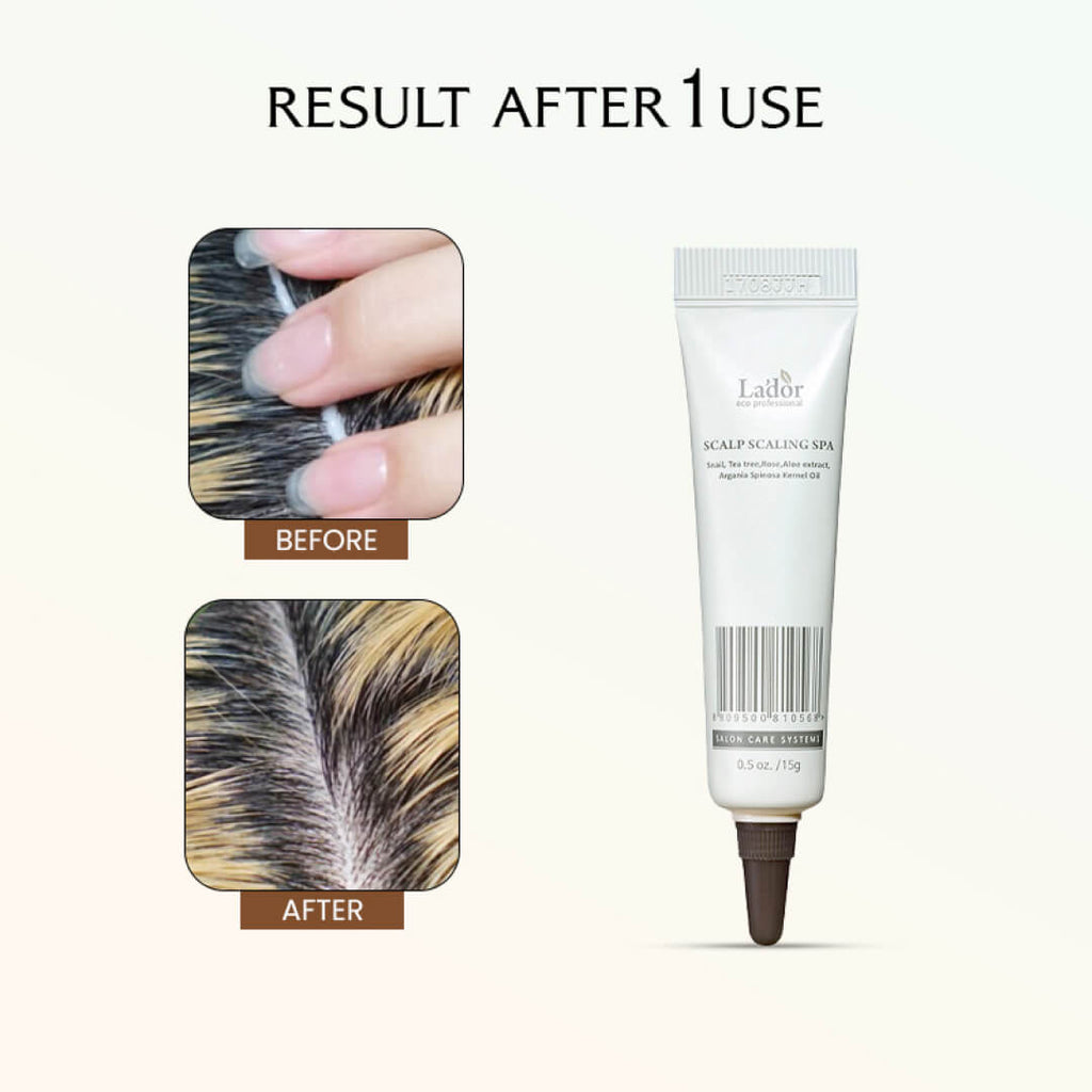Lador Scalp Scaling Spa - Pack Options: 1 or 4