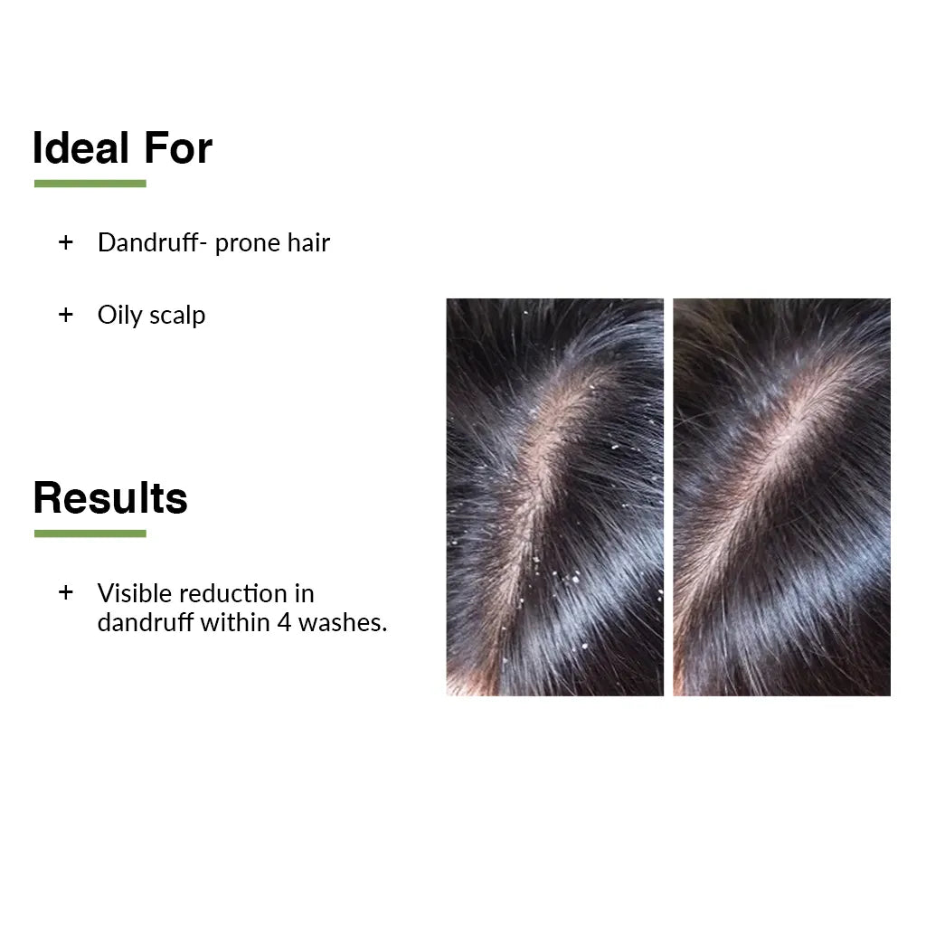 Fixderma Kairfoll Anti Dandruff Shampoo