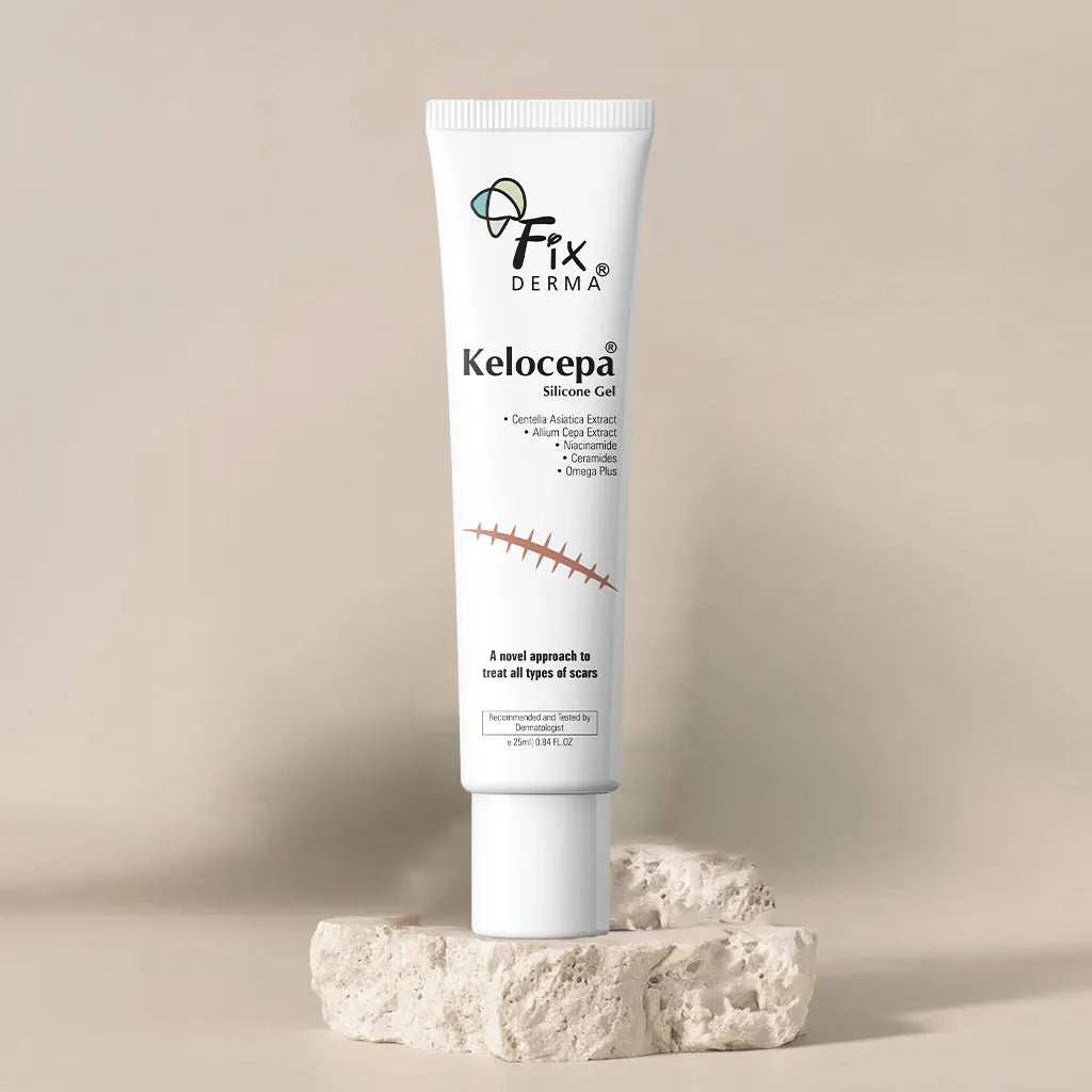 Fixderma Kelocepa Silicone Gel