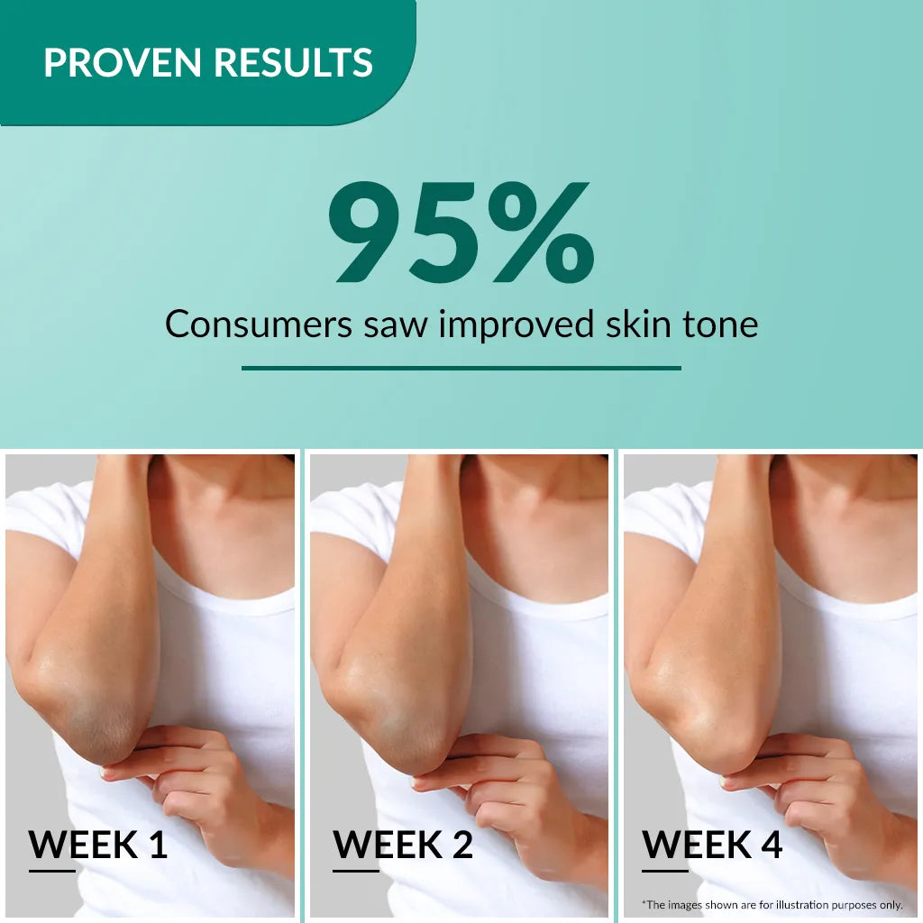 Fixderma Nigrifix Cream 50g Pack of 2