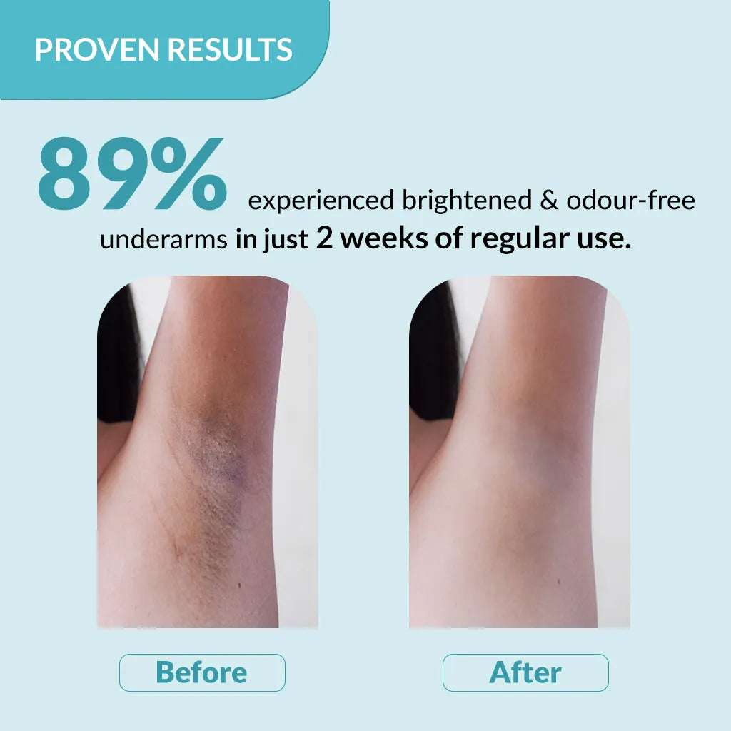 Fixderma Nigrifix Underarm Lightening Roll On