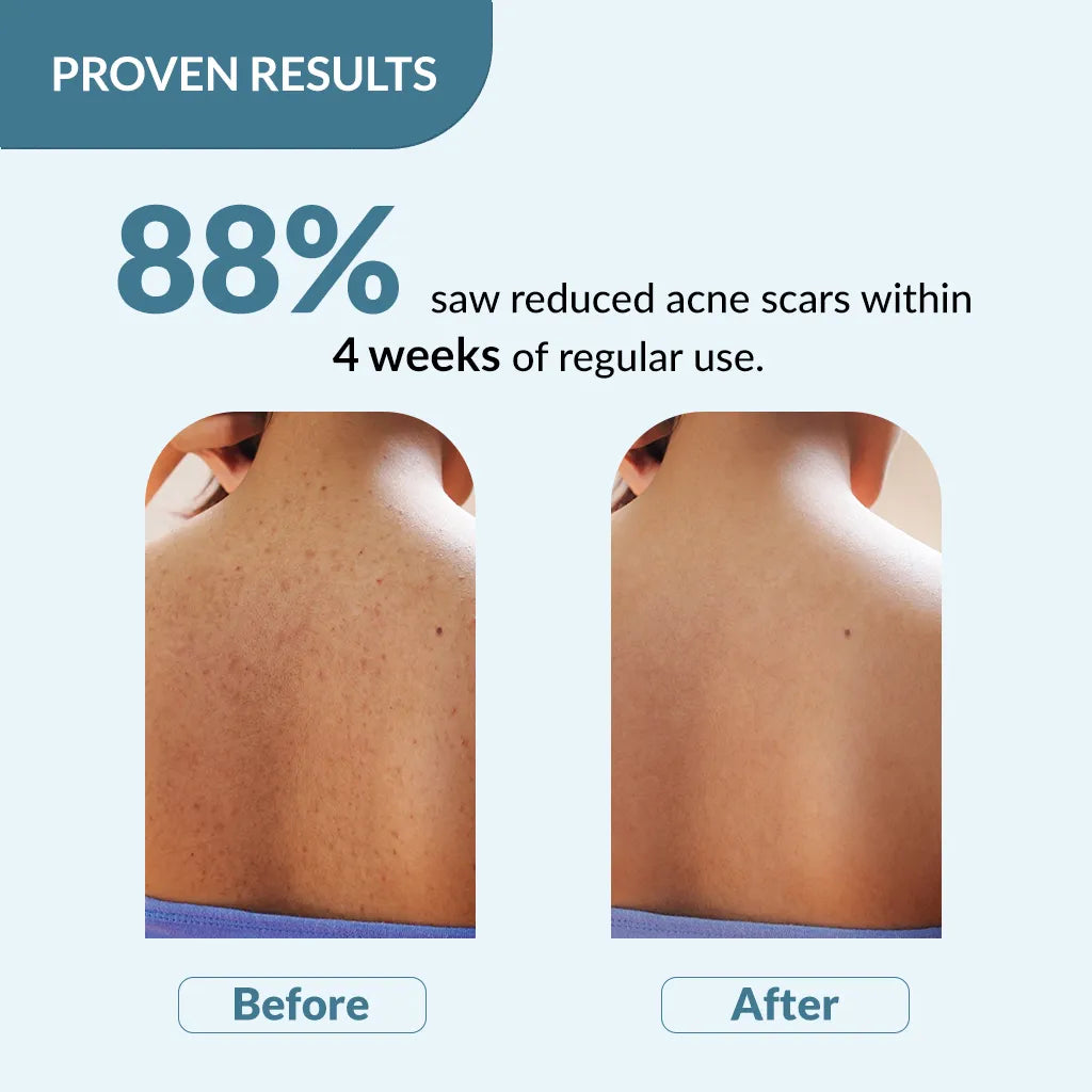 Fixderma Salyzap Body Wash 200ml Pack of 2