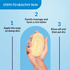 Fixderma Skarfix-TX De-Pigmentation & Brightening Soap